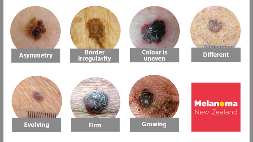 Self check examples width