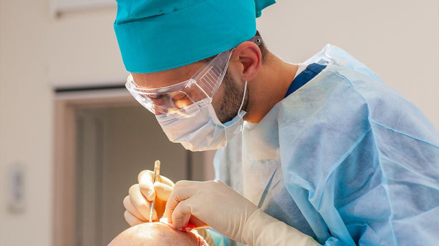 22jul balding treatments transplant width